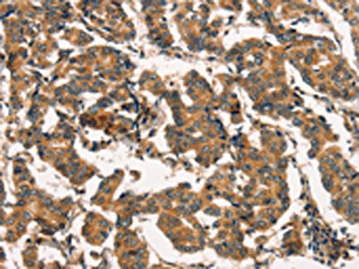 ARL6IP1 Antibody