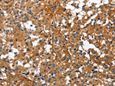 BGN Antibody