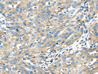 TXNDC5 Antibody