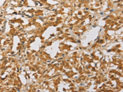 ARHGEF5 Antibody