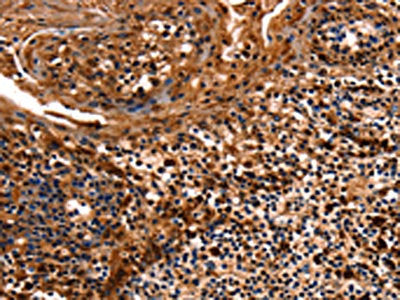 HSPD1 Antibody