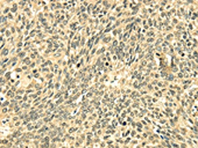 ECE2 Antibody