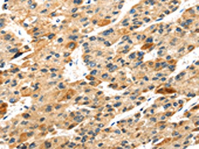 S100A14 Antibody