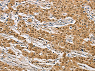 ARHGAP25 Antibody