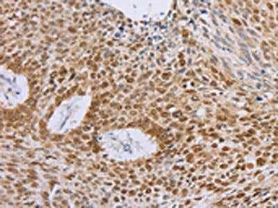 MCM5 Antibody
