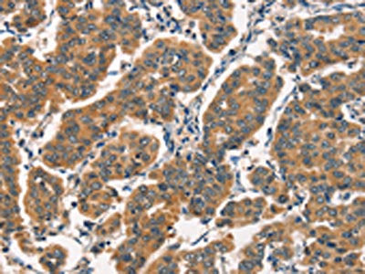 ARL6IP1 Antibody