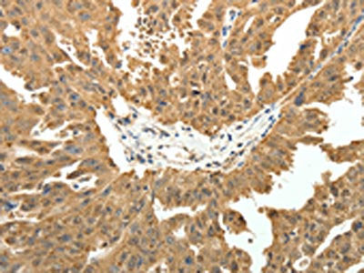 PTCH1 Antibody