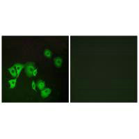 FOXE1 Antibody