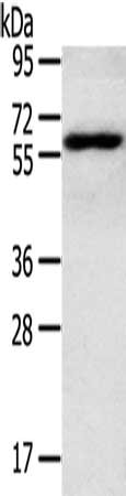 RORA Antibody