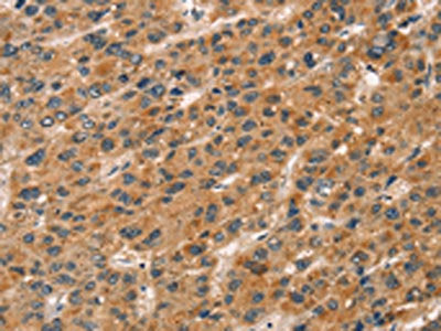 CXCR6 Antibody