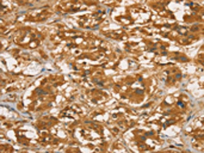 RBBP8 Antibody