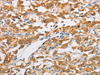 FARSB Antibody