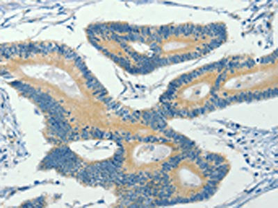 ASB8 Antibody