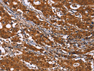 DCBLD2 Antibody