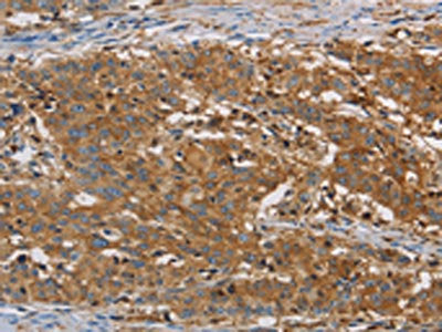 CFL1 Antibody