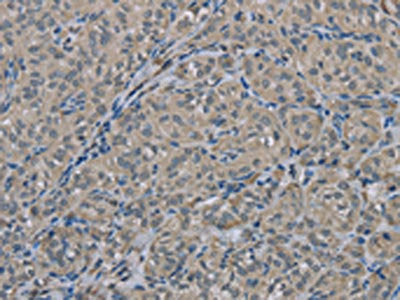EDN1 Antibody
