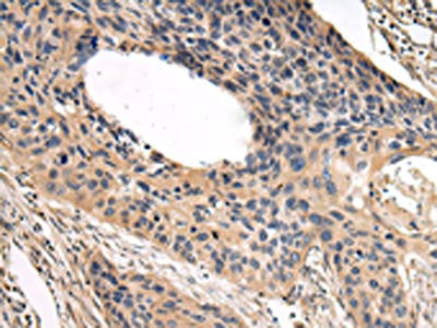 USP15 Antibody