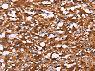 BRK1 Antibody
