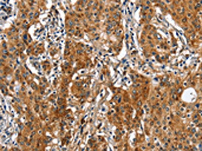 BGN Antibody