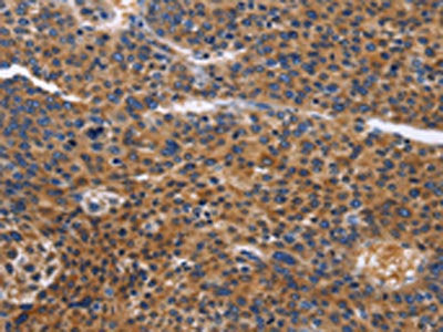 ACVR2B Antibody