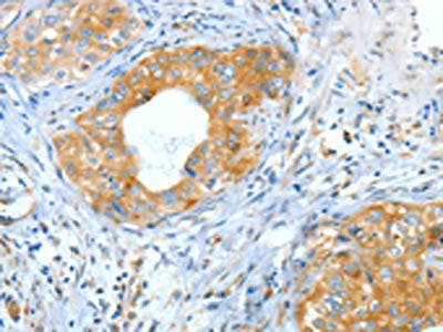 ASNS Antibody
