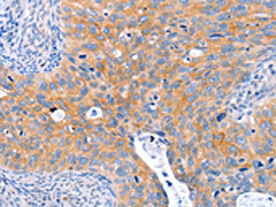ABO Antibody