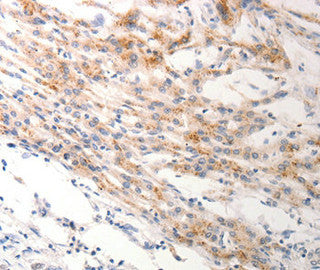 KRT6C Antibody