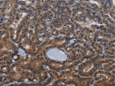INSIG2 Antibody
