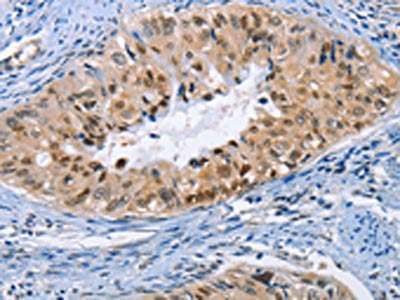 BAG1 Antibody