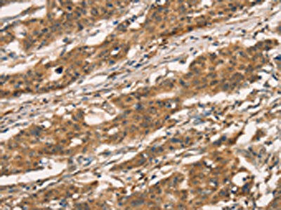 CXCR6 Antibody