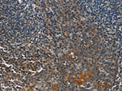 CACNB1 Antibody