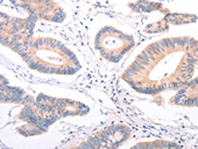 F9 Antibody