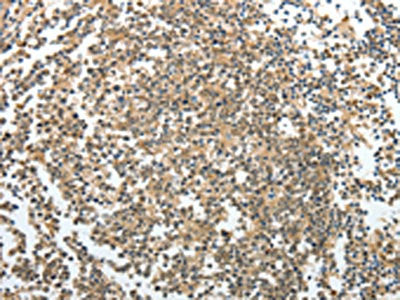 PRMT2 Antibody