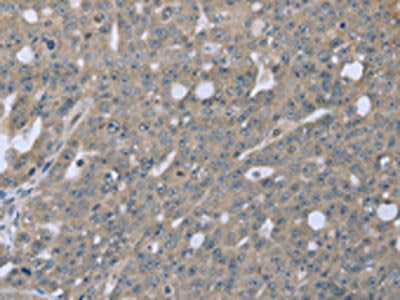 BMX Antibody
