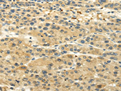 UGT1A6 Antibody