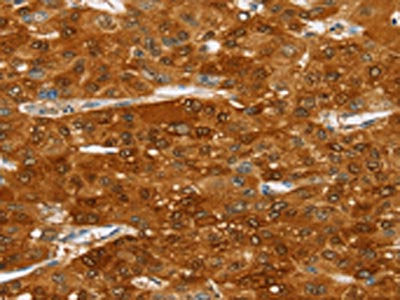 SULT2A1 Antibody