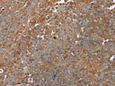 FAIM2 Antibody