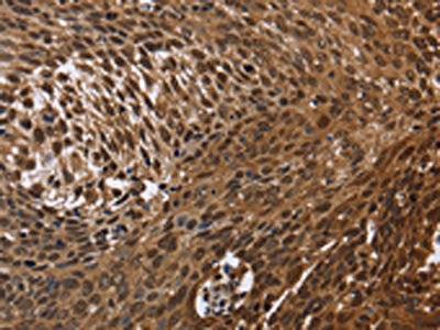 DCP1A Antibody