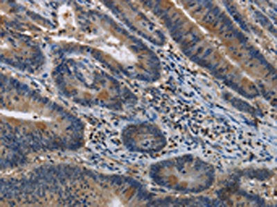 ITPR2 Antibody