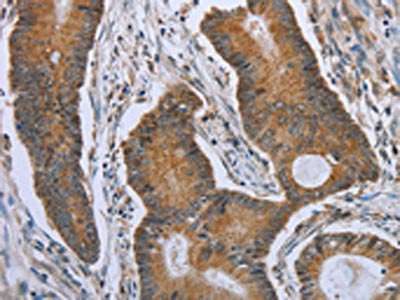 TNFRSF13C Antibody