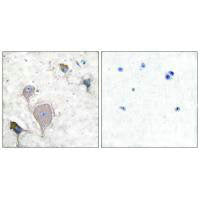 PRPH Antibody