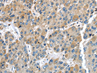 IGFBP4 Antibody