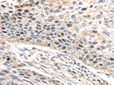 TPX2 Antibody