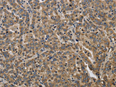 KCNMB2 Antibody