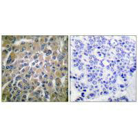 CGB Antibody