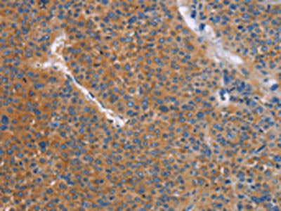 TLR8 Antibody