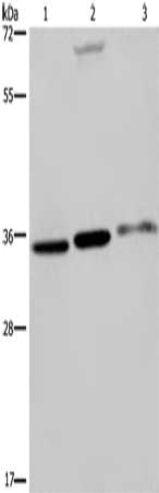 PITX2 Antibody