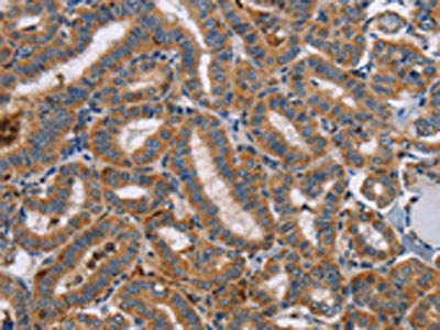 TLR8 Antibody