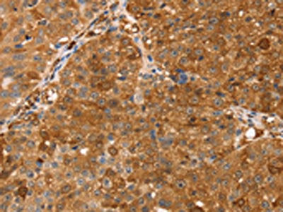 TMSB10 Antibody