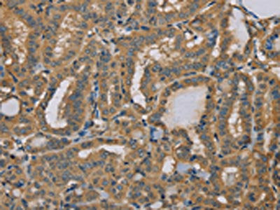 MYL3 Antibody
